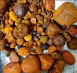 High Quality Gallstones