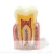 Import dental educational science caries teeth model from China