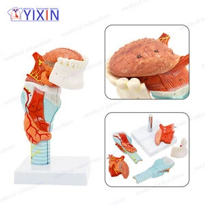 Meidcal Supplies and Educational Equipment 5 Parts Human Larynx Anatomical Model with Tongue and Teeth