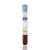 Import Prp Medical Blood Collection Tubes Platelet Rich Plasma Prp Tube for Hair Repair/Beauty Skin from China