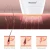 Import Photon under armpits hair removal home use IPL laser hair remover from China