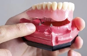 Smooth Surface Rubber OEM Denture Dental Lab Digital Dental Models