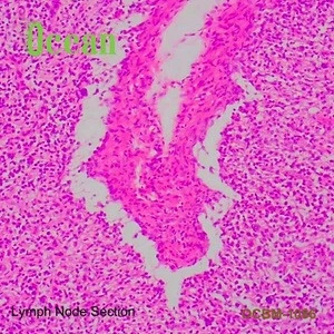 Lymph Node Section histology slide for education used , prepared microscope slides