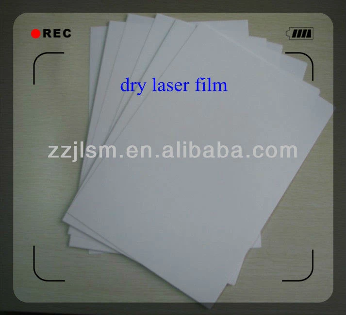 White Laser Dry X Ray Film (11&#39;&#39; * 14&#39;&#39;)