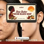 African Black Soap Raw Shea Butter Vegan Oil Control Deep Cleansing Moisturizing Bar Glowing Skin Handmade No Harsh