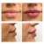 5CC Manufactory Price lips plastic injection molding hya dermal fillers