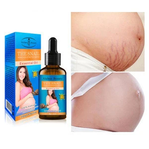 Aichun Beauty Effective Natural Snail Tightening Mummy Repair  Removal Stretch Mark Essential Oil
