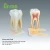 Import Detachable Human Teeth Models  Anatomical  molar teeth model medical model from China