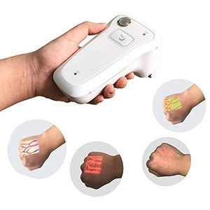 Medical Hospital Injection Vein Locator Vine Detector Cheapest Portable Infrared Vein Finder Clinical Analytical Instruments